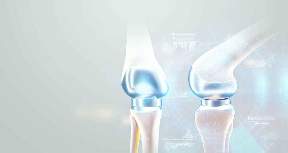 Robotic Knee Replacement Surgery in Navi Mumbai by Dr. Bharat Kumar